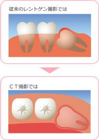 CT画像診断